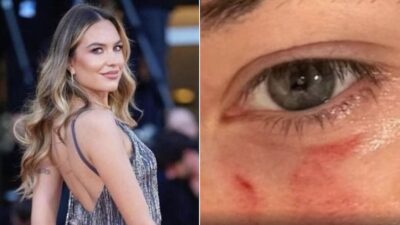 pamela gencini gianluca soncin festival venezia foto lividi