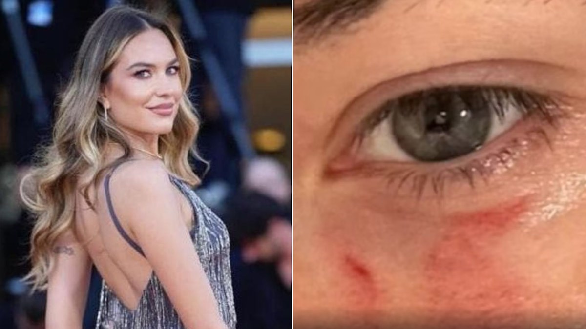 pamela gencini gianluca soncin festival venezia foto lividi