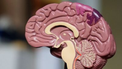 tumore cervello cura sperimentale